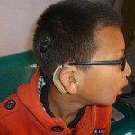 hearingnepal cochlear support