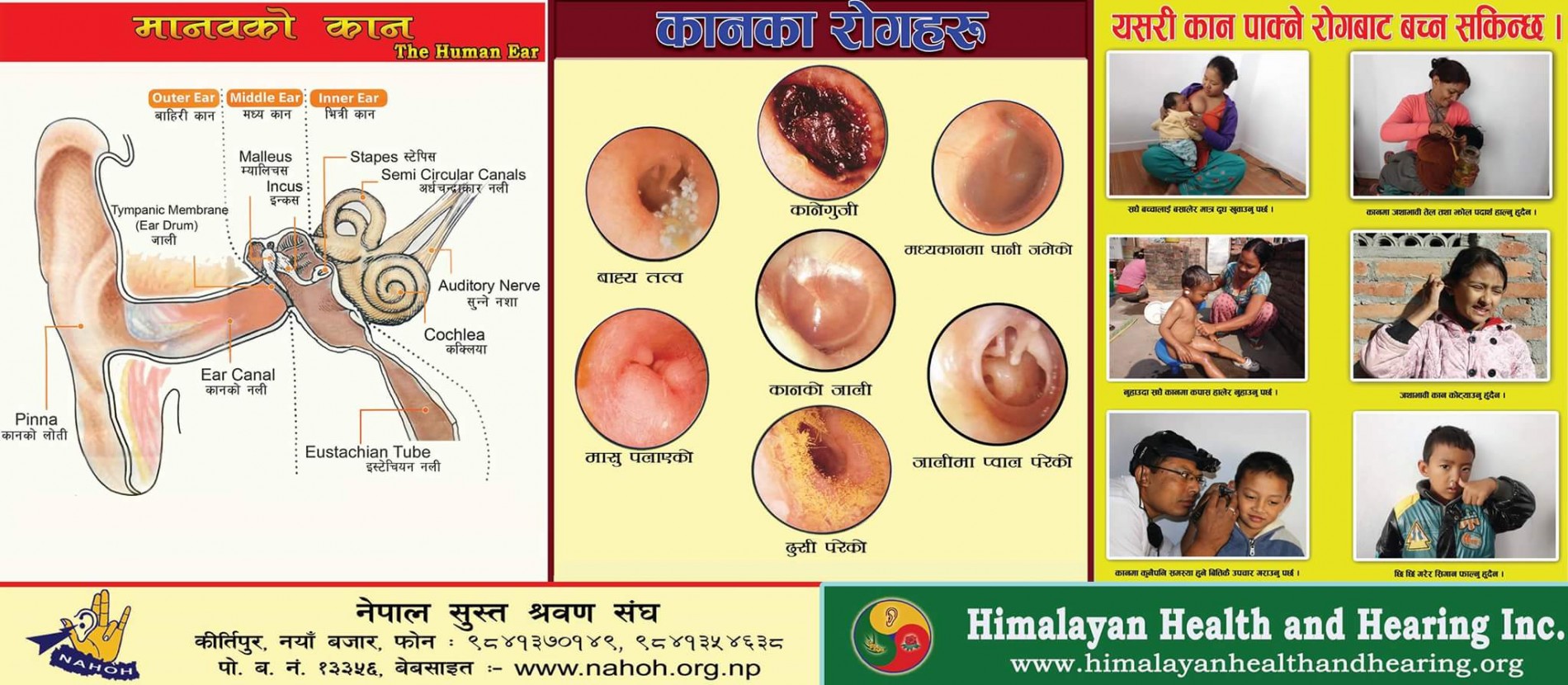3-in 1 education poster developed by NAHOH & HHH for use at ear camps and education programs